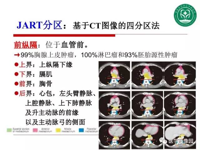 【PPT】纵隔肿瘤的影像检查规范及诊断思路