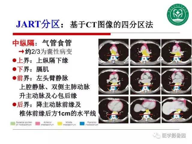 【PPT】纵隔肿瘤的影像检查规范及诊断思路