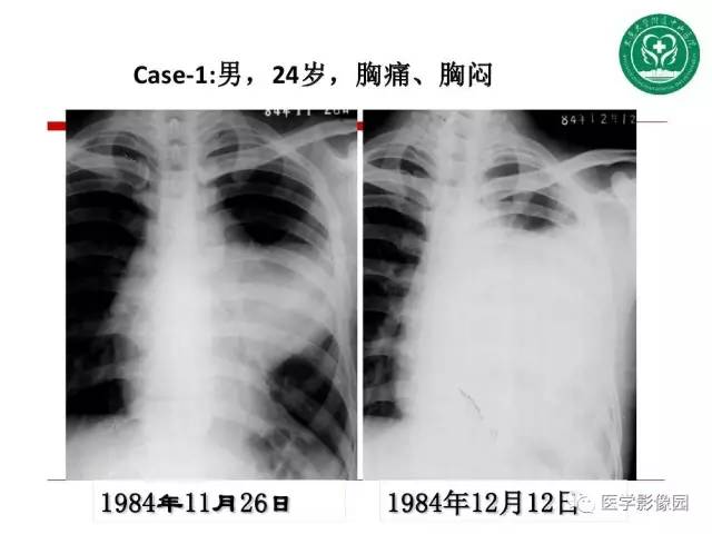 【PPT】纵隔肿瘤的影像检查规范及诊断思路