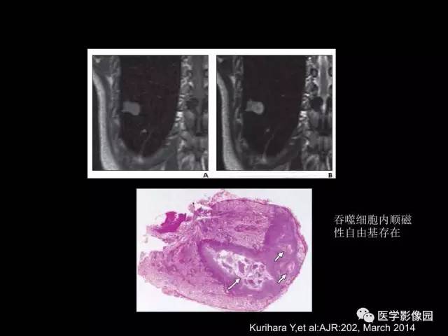 【PPT】肺结节MRI检查技术及诊断思路