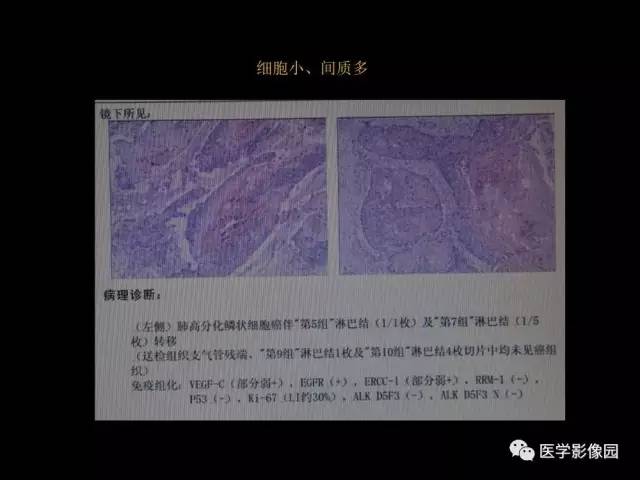 【PPT】肺结节MRI检查技术及诊断思路