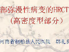 肺部弥漫性病变的HRCT诊断(高密度型部分)