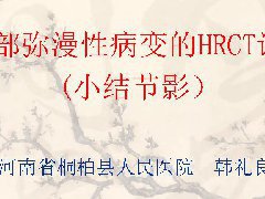 肺部弥漫性病变的HRCT诊断(小结节影部分)