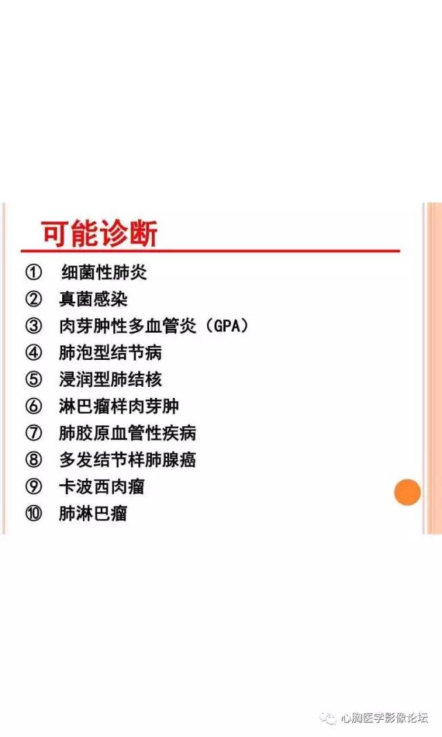 【病例】肺淋巴瘤样肉芽肿LYG一例CT影像诊断与鉴别