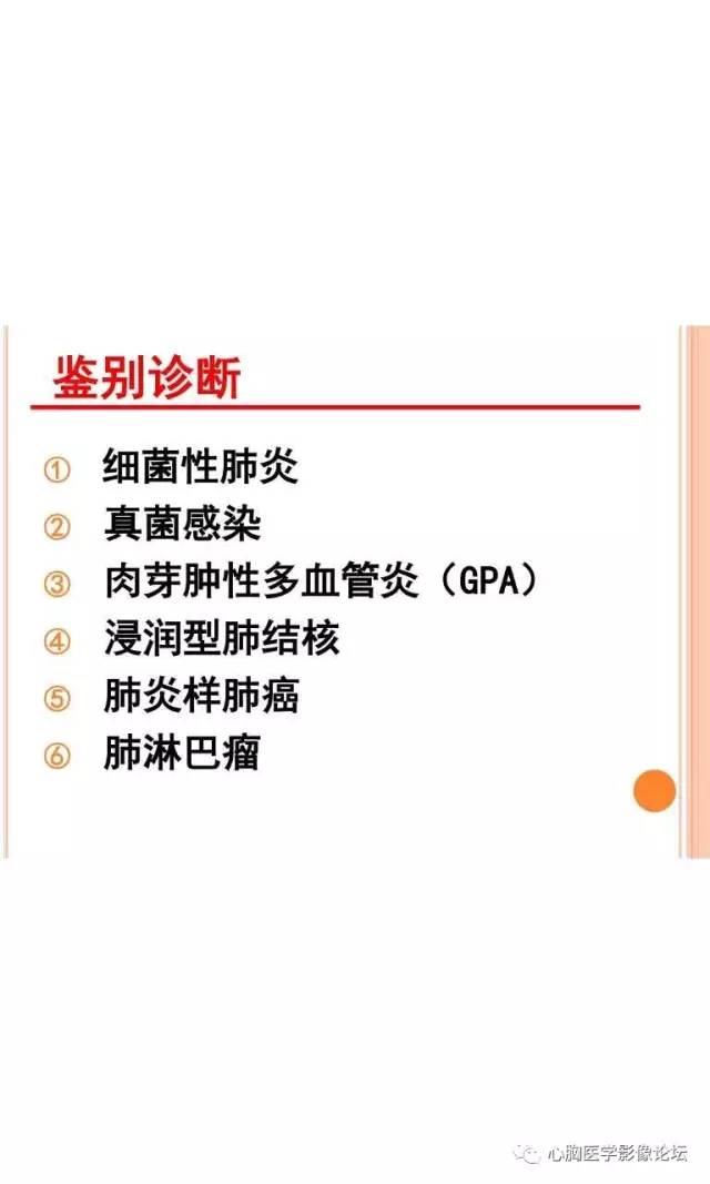 【病例】肺淋巴瘤样肉芽肿LYG一例CT影像诊断与鉴别