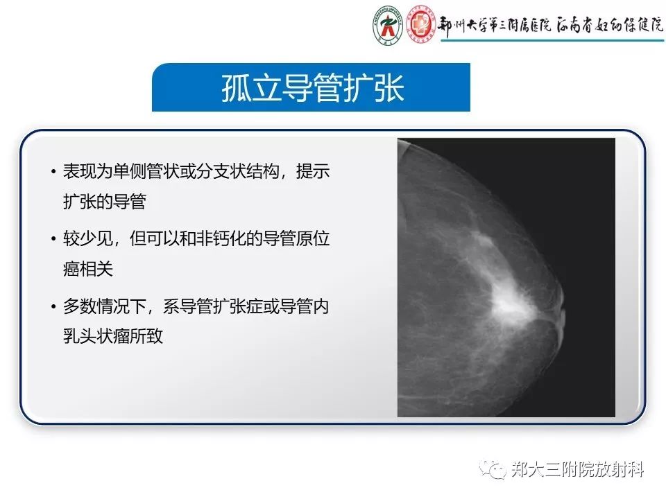 【PPT】乳腺X线特殊征象与合并征象 【PPT】乳腺X线特殊征象与合并征象