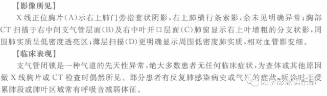 【病例】支气管闭锁1例CT