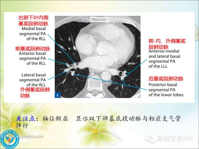 【PPT】肺动、静脉影像断层解剖图解