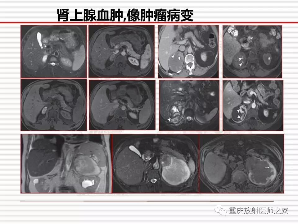 【PPT】
