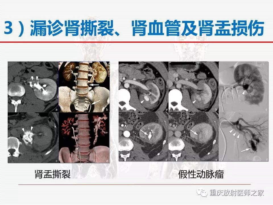 【PPT】