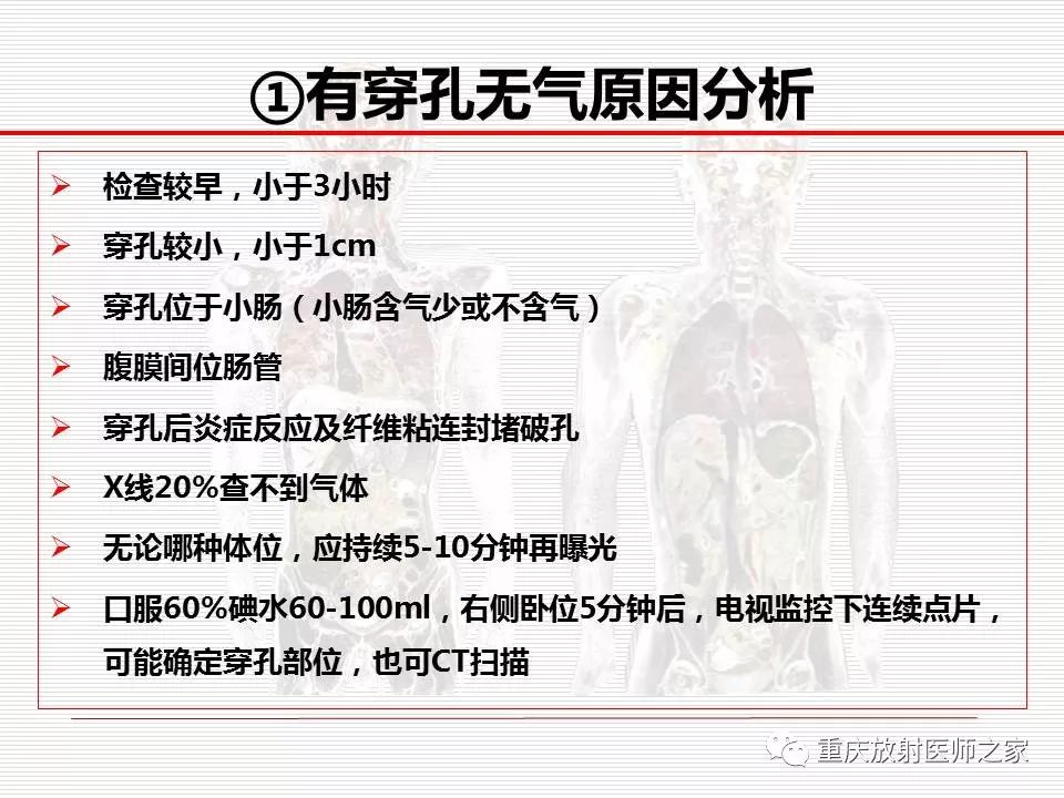 【PPT】