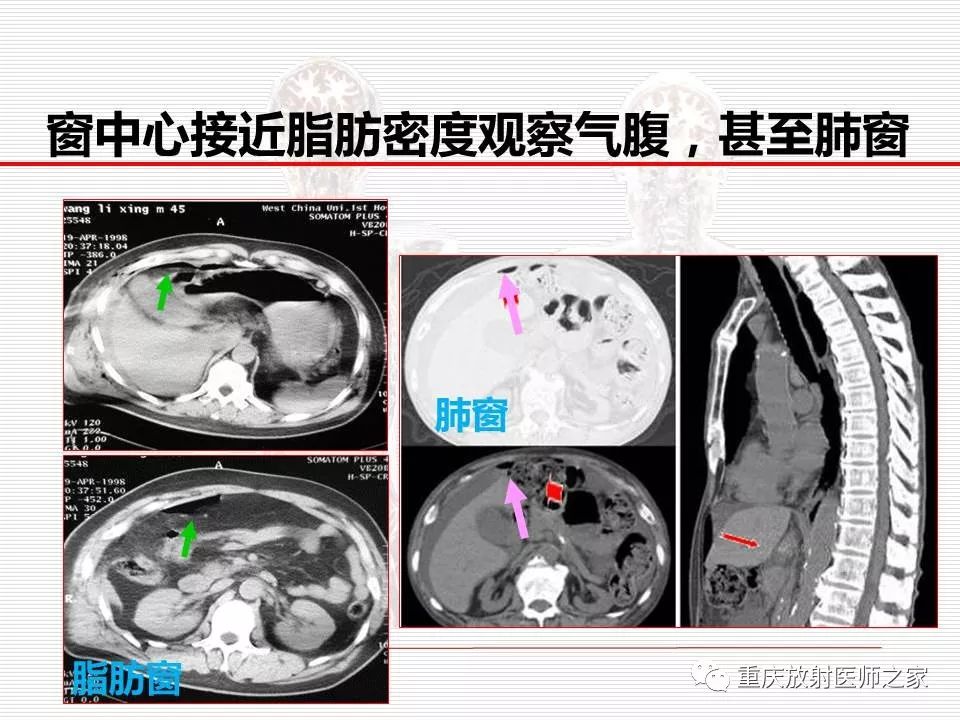 【PPT】