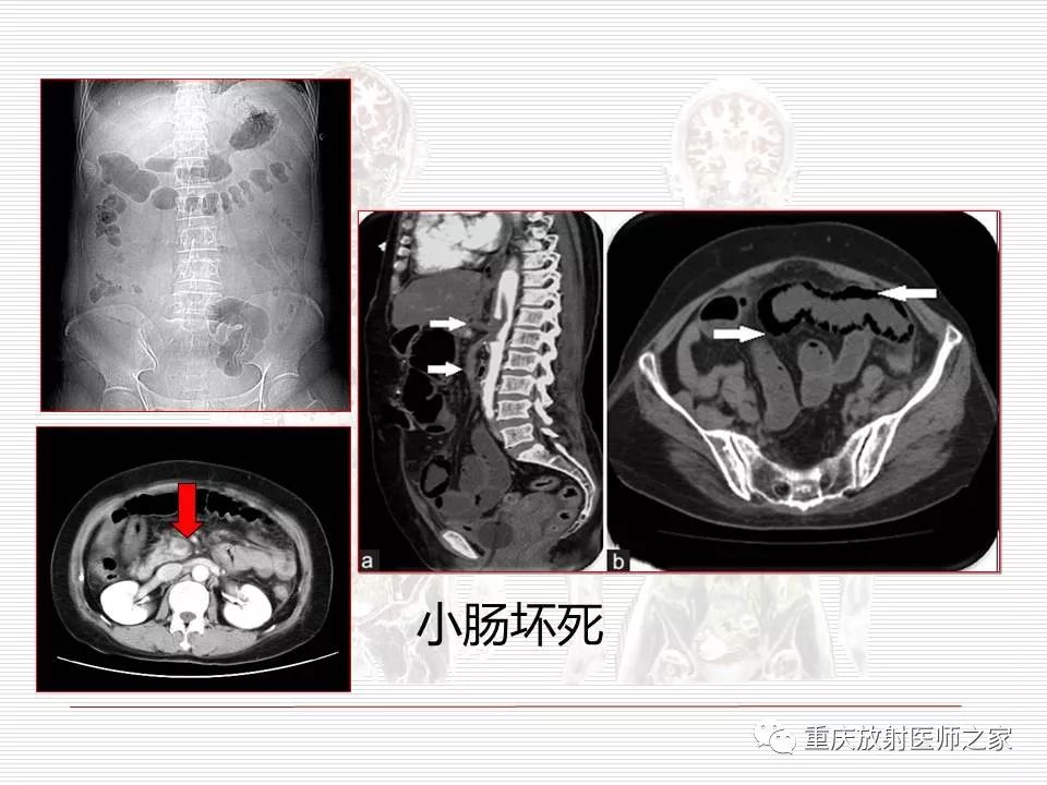 【PPT】