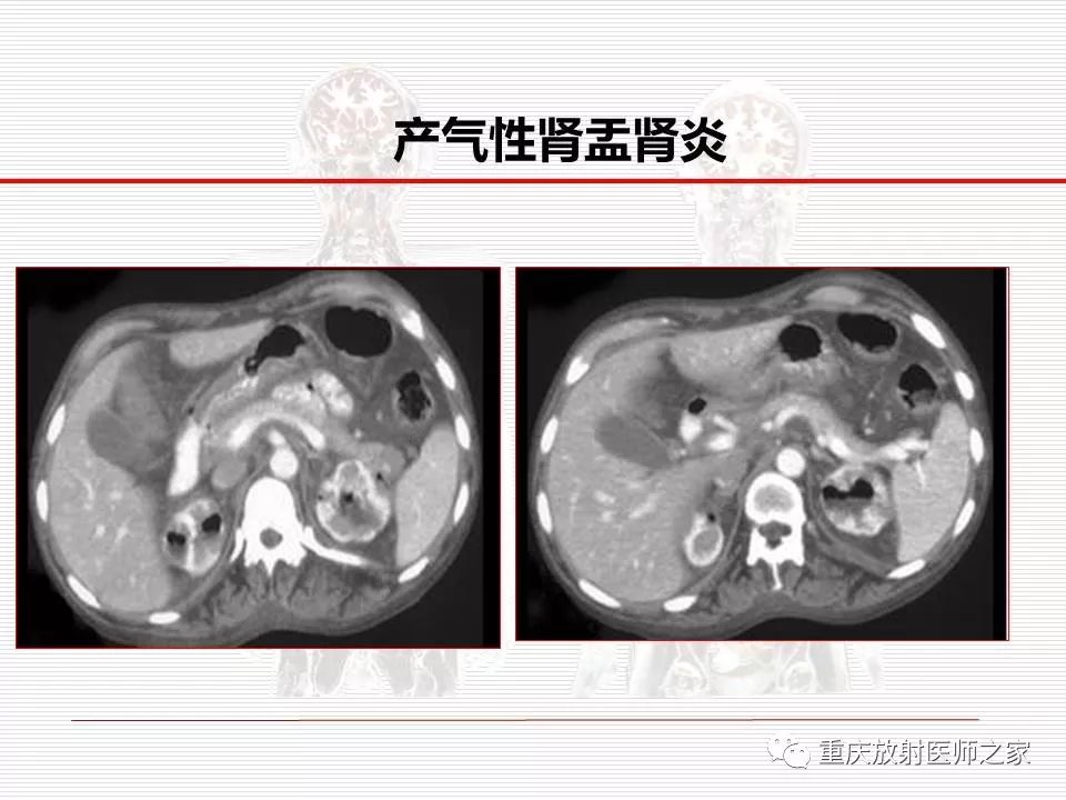 【PPT】