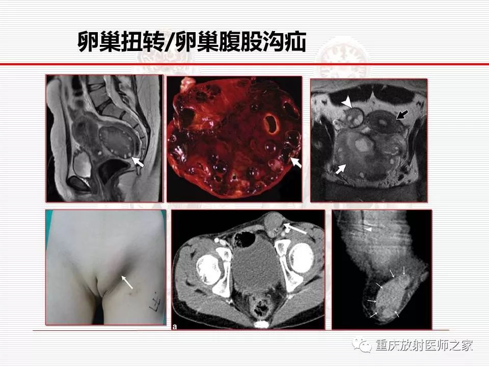 【PPT】