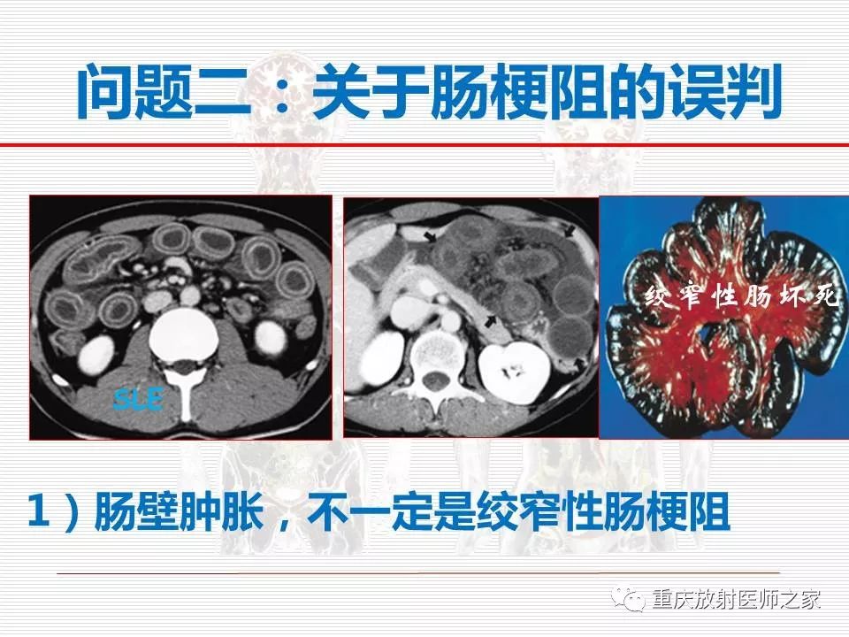 【PPT】