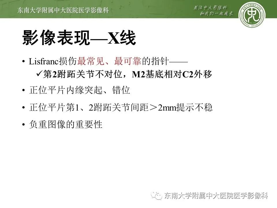 【PPT】Lisfranc损伤