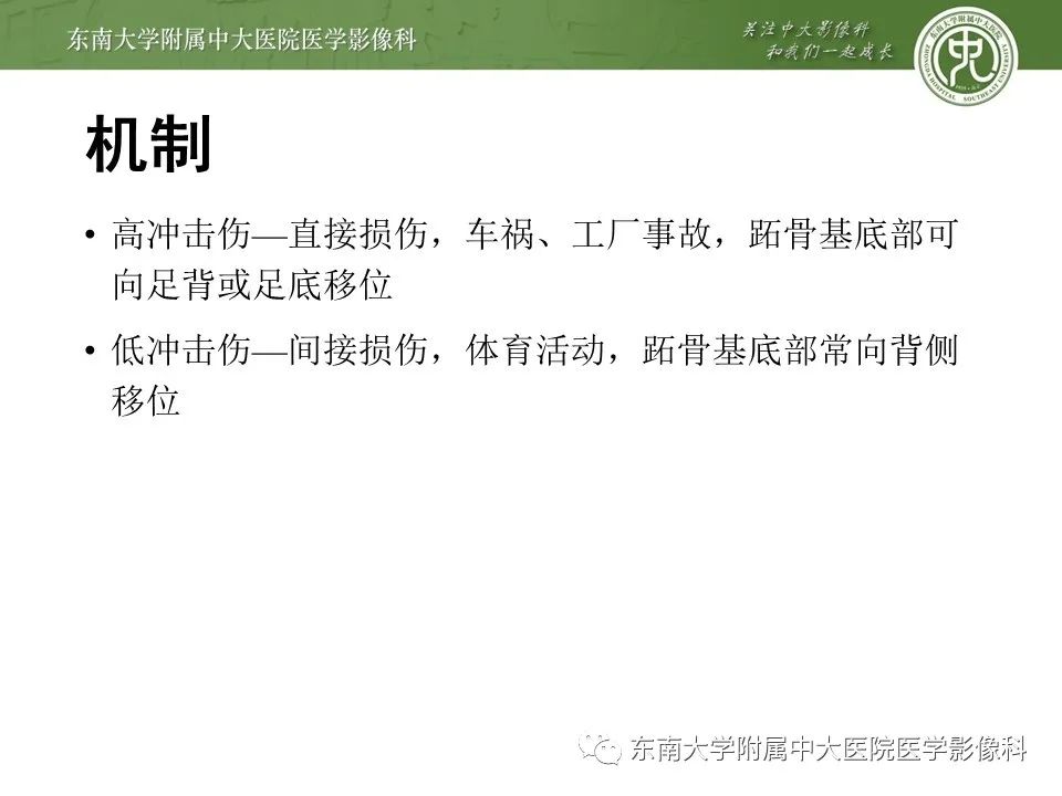 【PPT】Lisfranc损伤