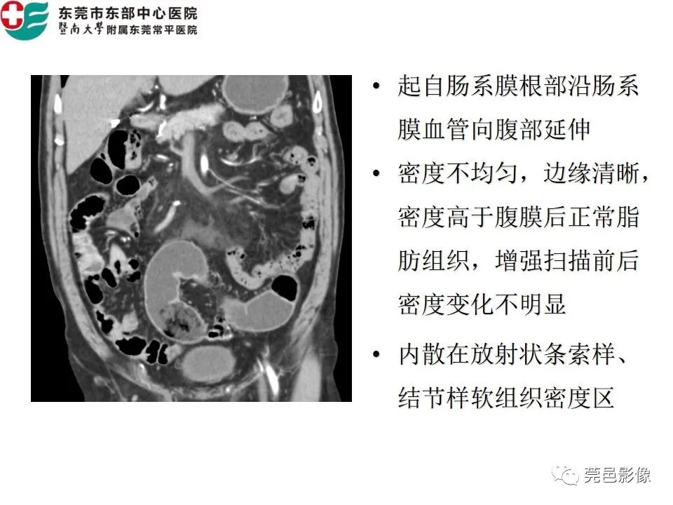 【PPT】肠系膜脂膜炎的CT表现
