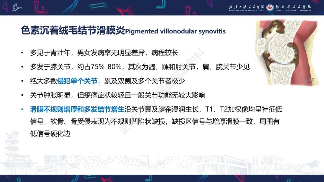 【PPT】关节痛风影像诊断