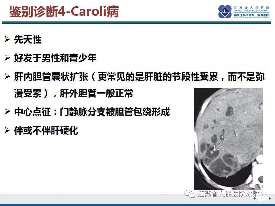 【病例】复发性化脓性胆管炎1例CT及MR影像