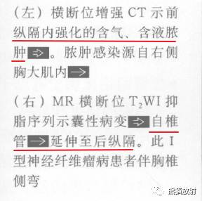 “纵隔囊性肿块”的鉴别诊断