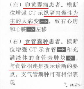 “纵隔囊性肿块”的鉴别诊断