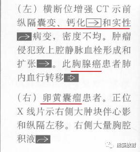 “纵隔囊性肿块”的鉴别诊断