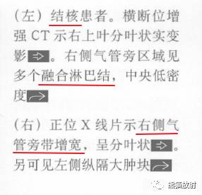 “纵隔囊性肿块”的鉴别诊断