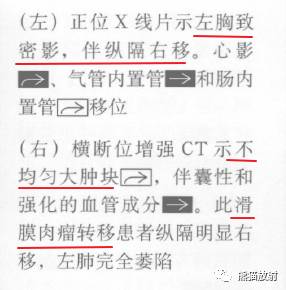 “纵隔囊性肿块”的鉴别诊断
