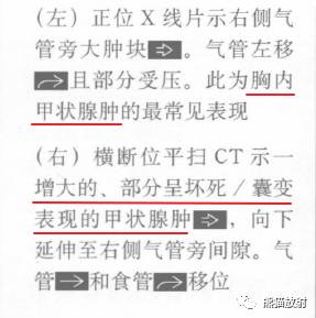 “纵隔囊性肿块”的鉴别诊断