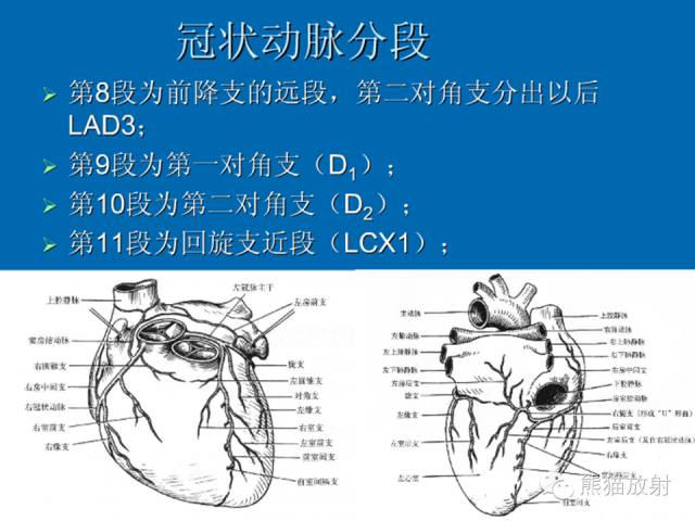 【PPT】冠状动脉解剖