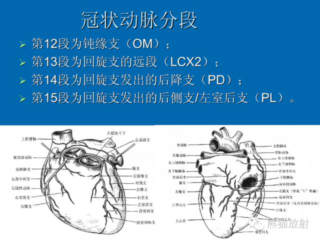 【PPT】冠状动脉解剖