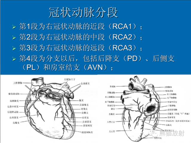 【PPT】冠状动脉解剖