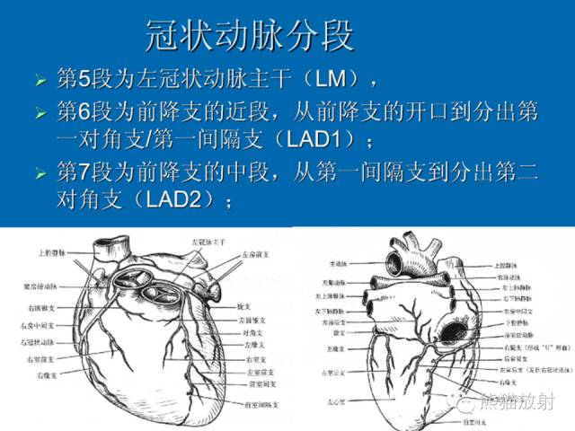 【PPT】冠状动脉解剖