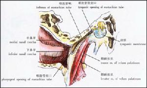 (图)中耳癌 (图)中耳癌