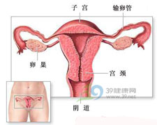 慢性子宫内膜炎