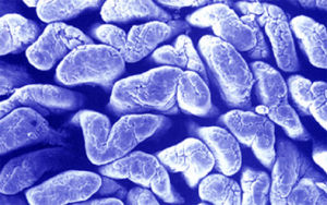 食管贲门失弛缓症