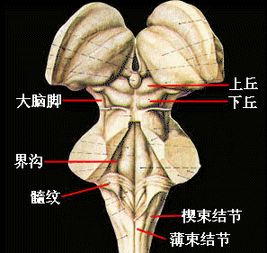 脑干肿瘤 脑干肿瘤