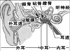 (图)中耳癌 (图)中耳癌