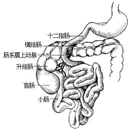先天性十二指肠闭锁 先天性十二指肠闭锁