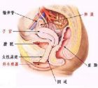 引产