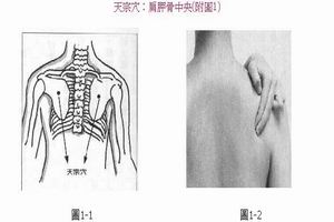 肋间神经痛 肋间神经痛