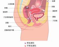 子宫内膜异位症 子宫内膜异位症