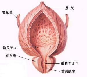 前列腺肥大症