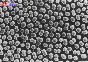 食管贲门失弛缓症