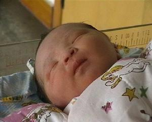 新生儿硬肿症 新生儿硬肿症