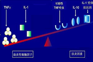 类风湿性关节炎