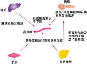 妊娠糖尿病 妊娠糖尿病