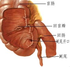阑尾炎 阑尾炎